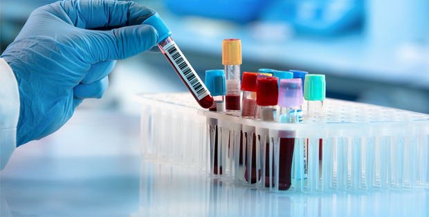 Servizi 11 analisi sangue